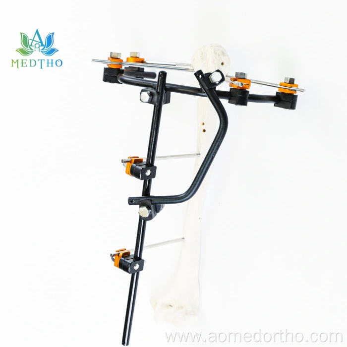 humerus fracture treatment